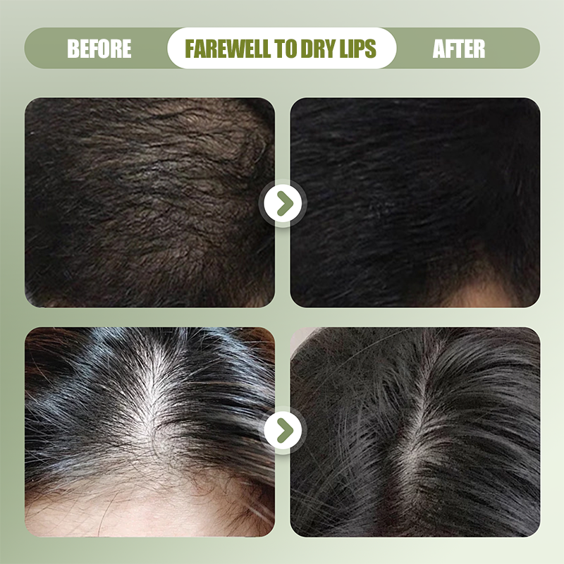 🎉Buy 2 Get 1 Free🎉Natural Shampoo Bar For Strengthening Hair