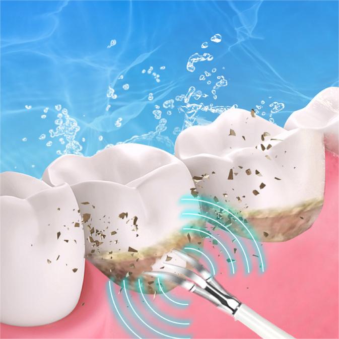 💎Surprise Price ￡9.99!!🦷✨Electric Ultrasonic Dental Scaler for Tartar and Plaque Removal