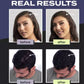 🔥HOT SALE 50% OFF🎁Hair Building Fibers Set for Thinning Hair & Bald Spots