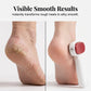 📢📢50% OFF !! ⏰Double-Sided Foot Scraper for Callus Removal